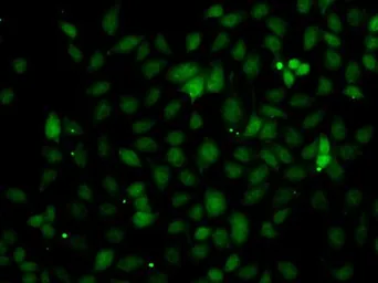 Anti-C1s antibody used in Immunocytochemistry/ Immunofluorescence (ICC/IF). GTX64606