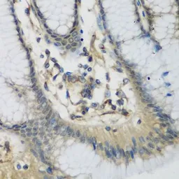 Anti-C1s antibody used in IHC (Paraffin sections) (IHC-P). GTX64606