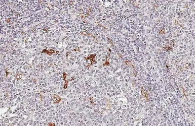 Anti-ETNK1 antibody [HL5426] used in IHC (Paraffin sections) (IHC-P). GTX646068