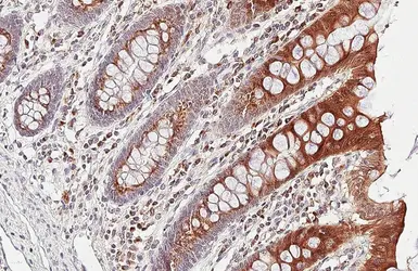 Anti-ETNK1 antibody [HL5426] used in IHC (Paraffin sections) (IHC-P). GTX646068