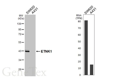 Anti-ETNK1 antibody [HL5426] used in Western Blot (WB). GTX646068