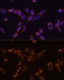Anti-STK3 antibody used in Immunocytochemistry/ Immunofluorescence (ICC/IF). GTX64607