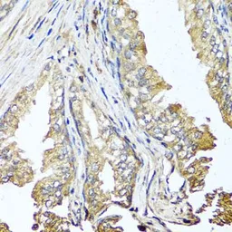 Anti-STK3 antibody used in IHC (Paraffin sections) (IHC-P). GTX64607