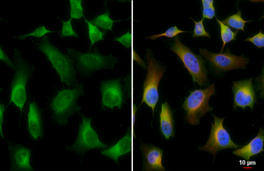 Anti-VTA1 antibody [HL5428] used in Immunocytochemistry/ Immunofluorescence (ICC/IF). GTX646070