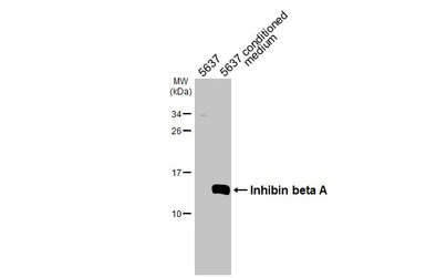 Anti-Inhibin beta A antibody [HL5443] used in Western Blot (WB). GTX646085