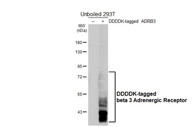Anti-beta 3 Adrenergic Receptor antibody [HL5445] used in Western Blot (WB). GTX646087