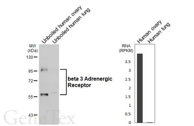 Anti-beta 3 Adrenergic Receptor antibody [HL5445] used in Western Blot (WB). GTX646087