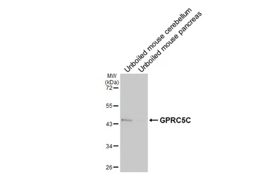 Anti-GPRC5C antibody [HL5446] used in Western Blot (WB). GTX646088