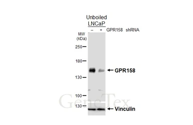 Anti-GPR158 antibody [HL5447] used in Western Blot (WB). GTX646089