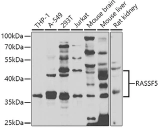 Anti-NORE1 antibody used in Western Blot (WB). GTX64609