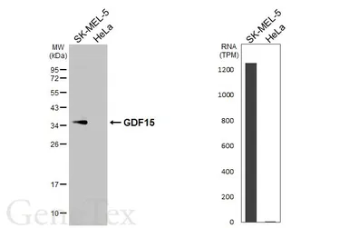 Anti-GDF15 antibody [HL5448] used in Western Blot (WB). GTX646090