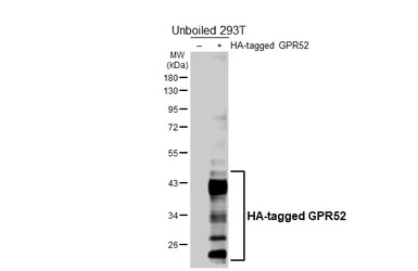 Anti-GPR52 antibody [HL5461] used in Western Blot (WB). GTX646103