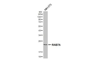 Anti-RAB7A antibody [HL5462] used in Western Blot (WB). GTX646104