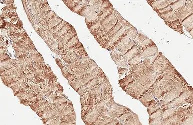 Anti-RAB7A antibody [HL5462] used in IHC (Paraffin sections) (IHC-P). GTX646104