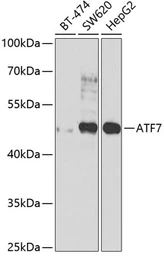 Anti-ATF7 antibody used in Western Blot (WB). GTX64611