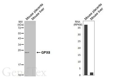 Anti-GPX8 antibody [HL5475] used in Western Blot (WB). GTX646117