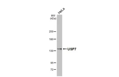 Anti-USP7 antibody [HL5485] used in Western Blot (WB). GTX646149