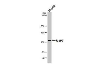 Anti-USP7 antibody [HL5485] used in Western Blot (WB). GTX646149