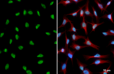 Anti-USP7 antibody [HL5485] used in Immunocytochemistry/ Immunofluorescence (ICC/IF). GTX646149