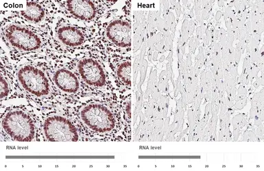 Anti-USP7 antibody [HL5485] used in IHC (Paraffin sections) (IHC-P). GTX646149