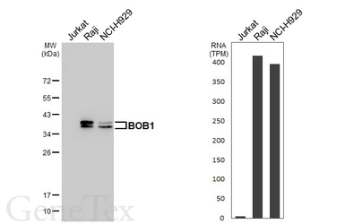 Anti-BOB1 antibody [HL5492] used in Western Blot (WB). GTX646156