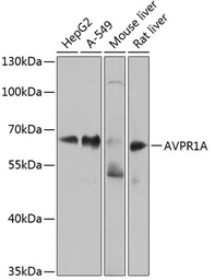 Anti-AVPR1A antibody used in Western Blot (WB). GTX64617