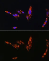 Anti-AVPR1A antibody used in Immunocytochemistry/ Immunofluorescence (ICC/IF). GTX64617
