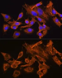 Anti-AVPR1A antibody used in Immunocytochemistry/ Immunofluorescence (ICC/IF). GTX64617