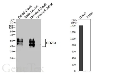 Anti-CD79a antibody [HL5516] used in Western Blot (WB). GTX646179