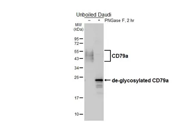 Anti-CD79a antibody [HL5516] used in Western Blot (WB). GTX646179