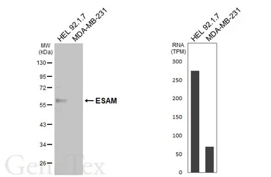 Anti-ESAM antibody [HL5518] used in Western Blot (WB). GTX646181