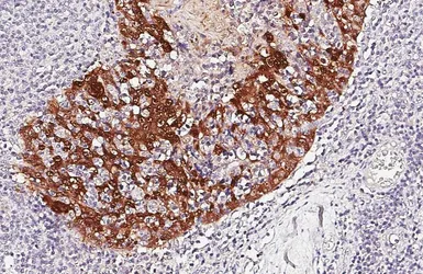Anti-14-3-3 sigma antibody [HL5525] used in IHC (Paraffin sections) (IHC-P). GTX646188