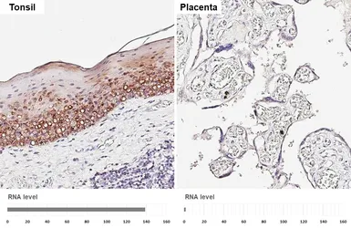 Anti-14-3-3 sigma antibody [HL5525] used in IHC (Paraffin sections) (IHC-P). GTX646188