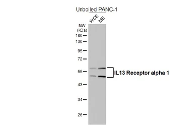 Anti-IL13 Receptor alpha 1 antibody [HL5529] used in Western Blot (WB). GTX646192