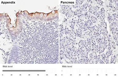 Anti-CEACAM7 antibody [HL5532] used in IHC (Paraffin sections) (IHC-P). GTX646195