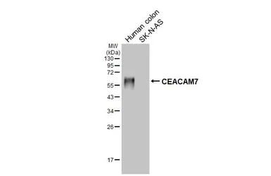 Anti-CEACAM7 antibody [HL5532] used in Western Blot (WB). GTX646195