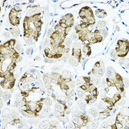 Anti-LRRC59 antibody used in IHC (Paraffin sections) (IHC-P). GTX64620