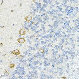 Anti-LRRC59 antibody used in IHC (Paraffin sections) (IHC-P). GTX64620
