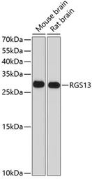 Anti-RGS13 antibody used in Western Blot (WB). GTX64621