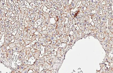 Anti-Claudin 1 antibody [HL5538] used in IHC (Paraffin sections) (IHC-P). GTX646212