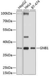 Anti-GNB1 antibody used in Western Blot (WB). GTX64622