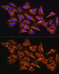 Anti-GNB1 antibody used in Immunocytochemistry/ Immunofluorescence (ICC/IF). GTX64622