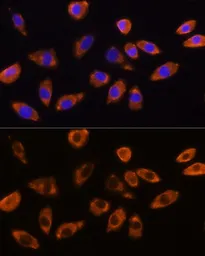 Anti-GNB1 antibody used in Immunocytochemistry/ Immunofluorescence (ICC/IF). GTX64622