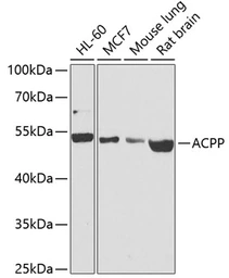 Anti-Prostatic Acid Phosphatase antibody used in Western Blot (WB). GTX64623