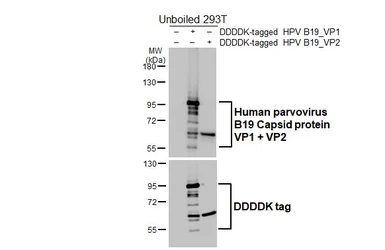 Anti-Human parvovirus B19 Capsid protein VP1 + VP2 antibody [HL5562] used in Western Blot (WB). GTX646236