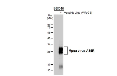 Anti-Mpox virus A35R antibody [HL5565] used in Western Blot (WB). GTX646239