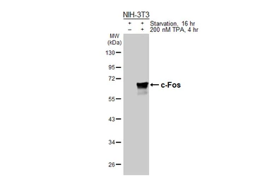 Anti-c-Fos antibody [HL5568] used in Western Blot (WB). GTX646242