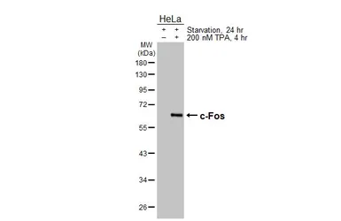 Anti-c-Fos antibody [HL5569] used in Western Blot (WB). GTX646243