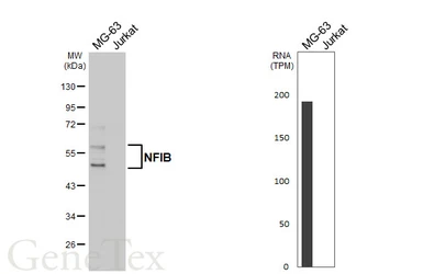 Anti-NFIB antibody [HL5571] used in Western Blot (WB). GTX646245