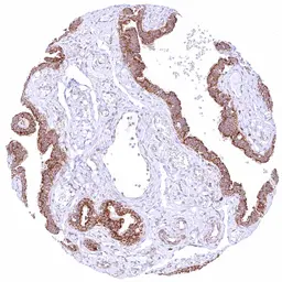 Anti-Bcl-XL antibody [HMV4724] HistoMAX&trade; used in IHC (Paraffin sections) (IHC-P). GTX646253